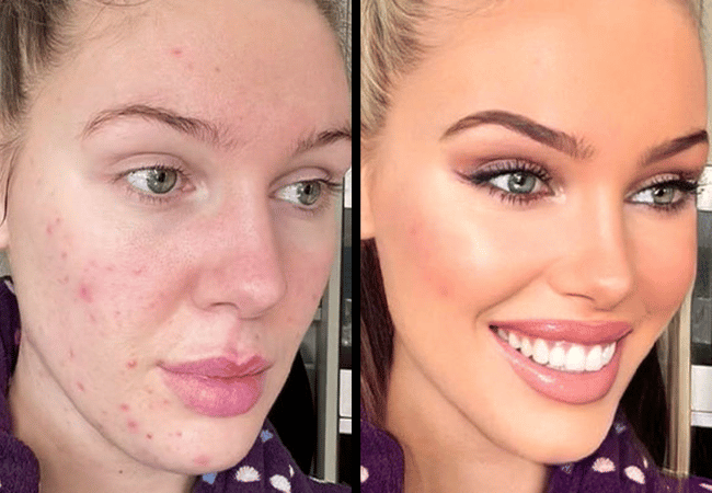 TikTok's Bold Glamour filter: AI or just a plain old makeup tool?